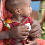 One of the malnourished children in Oromia region-WAZEMA